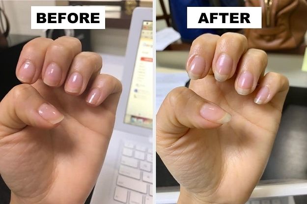 Professional Tan Clean Manicure Services at Seema's Hair & Skin Clinique in Borivali West, Mumbai 2 Professional Tan Clean Manicure Services at Seema’s Hair & Skin Clinique in Borivali West, Mumbai